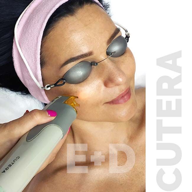 Лазерное омоложение